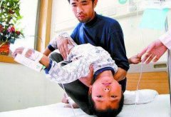 癫痫病最好的治疗的方法是什么