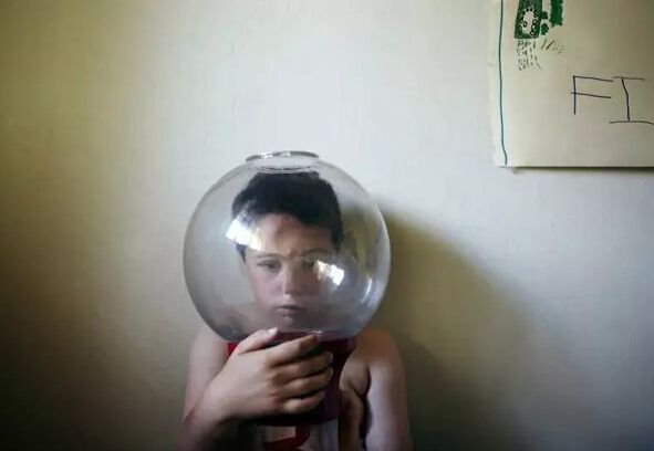 预防自闭症的方法有哪些