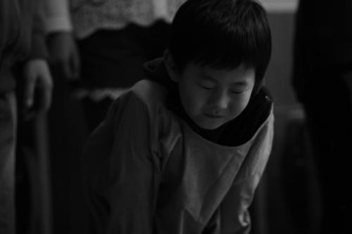 经颅磁治疗 孤独症有什么症状与表现